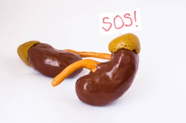 自然解剖3d 肾脏模型与标语牌 inscripted Sos 提到病人或医生的帮助。为所有症状、证候、疾病和肾脏和肾上腺的病症被设想