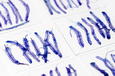 科學(xué)玻璃載玻片與真菌內(nèi)植物組織 s