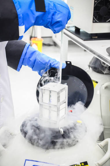 精子在液氮罐中冷凍儲存實驗室不育