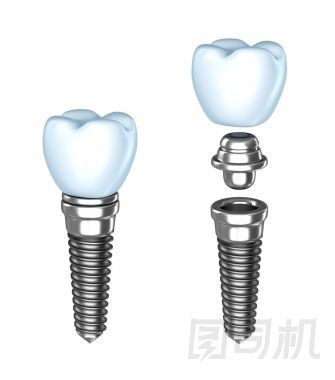 牙種植體。? ssembled 和拆卸。孤立對(duì)白色