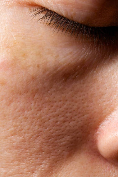 年輕女士的皮膚在30和35歲之間。特寫(xiě)