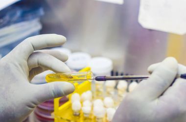 细菌接种在试管琼脂黄色培养基上使用由科学家接种循环在实验室油烟机内的烟雾罩