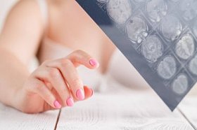 性感女性看 x 射线相片图片