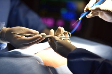 医疗团队在现代手术室进行外科手术。混合手术室的设备和医疗设备. 擦洗护士准备手术用的医疗器械