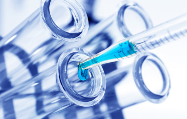 醫(yī)用玻璃器皿試管特寫照片