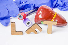 Lft 临床实验室医学首字母缩写或肝脏功能测试简称, 确定肝脏健康。词 Lft 是接近的图肝脏, 实验室试管用血液样品, 听诊器