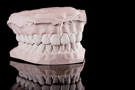 人类的牙齿、 模型