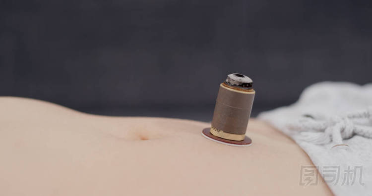 中醫(yī)治療 照片