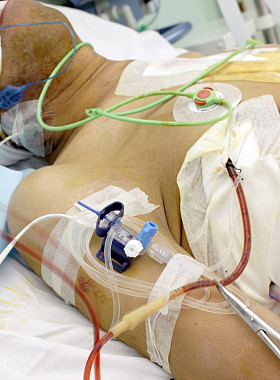 在加护病房的病人。重病在床上