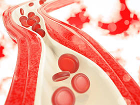 动脉粥样硬化和他们的治疗在白色背景