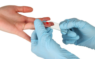 測試管的血手孤立上白照片