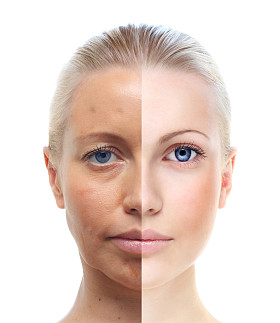 The portraits of women are white and isolated in their 20s to 40s