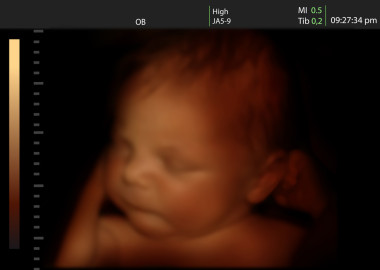 剛出生的嬰兒，像三維超聲的嬰兒在母親的子宮里的形象