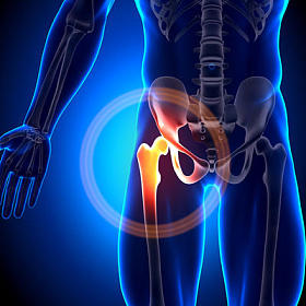 髋关节-解剖学骨头照片