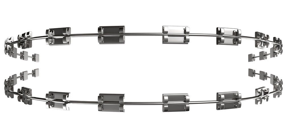 组装牙科大括号极端接近前面图片 组装牙科大括号极端接近前面图片