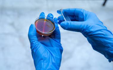 細(xì)菌研究。 微生物培養(yǎng)