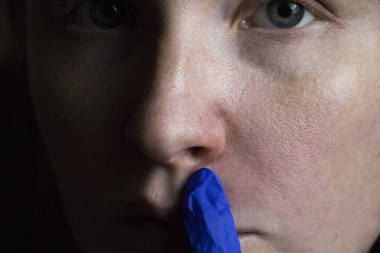 一個年輕女子鼻子上的割草病。痤瘡在臉上。由醫(yī)生進行檢查