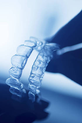 清除牙齿固定器图片