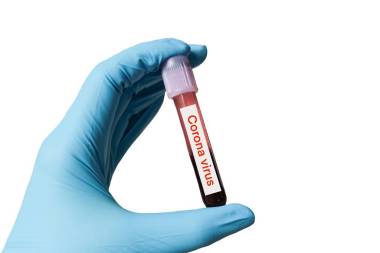 Coronavirus 2019年疫情爆發(fā)背景概念 