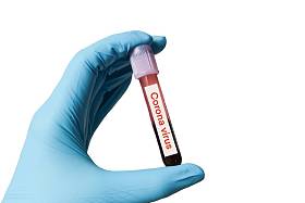 Coronavirus 2019年疫情爆发背景概念 