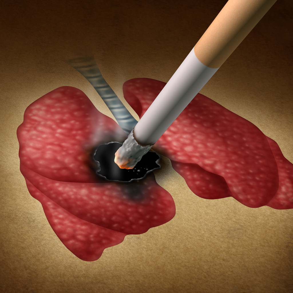 吸烟对健康的影响照片 吸烟对健康的影响照片