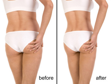 之前和之后圖片