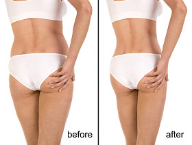 之前和之后图片