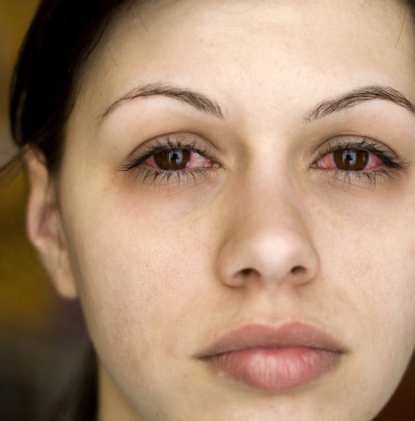 患病婦女的眼睛圖片