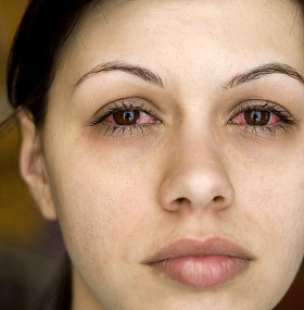 患病妇女的眼睛图片