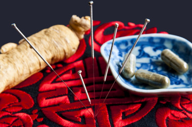 針灸法圖片