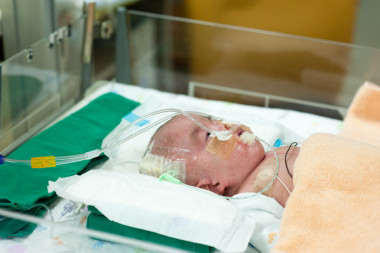 在 Icu 中的婴儿照片