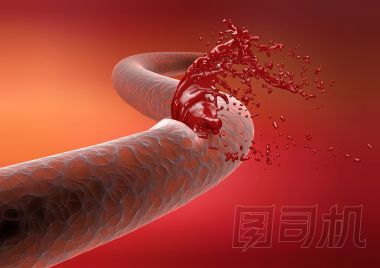 靜脈切動(dòng)脈破裂出血血液