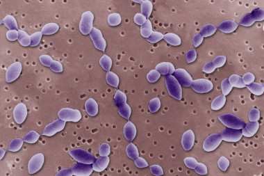 在電子顯微鏡下的厭氧