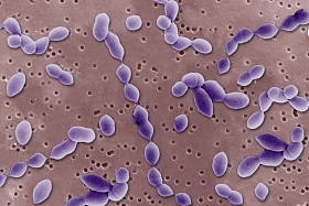 在电子显微镜下的厌氧