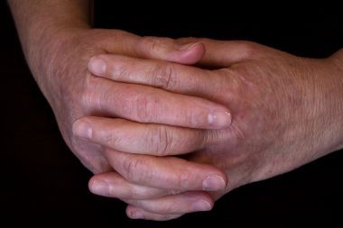 老人雙手皮膚疾病