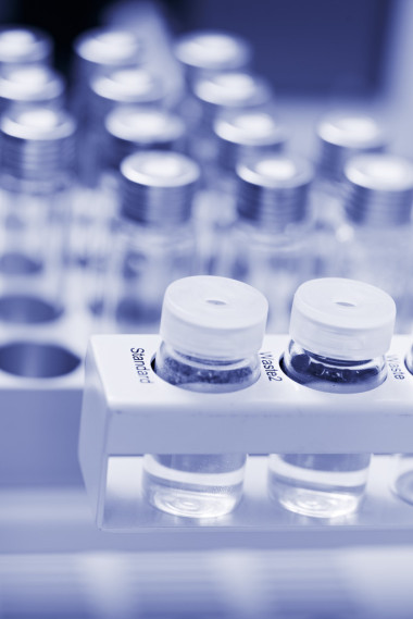 特写小实验室瓶盒中