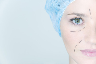 人脸整形手术图片