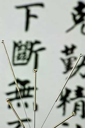 针灸法