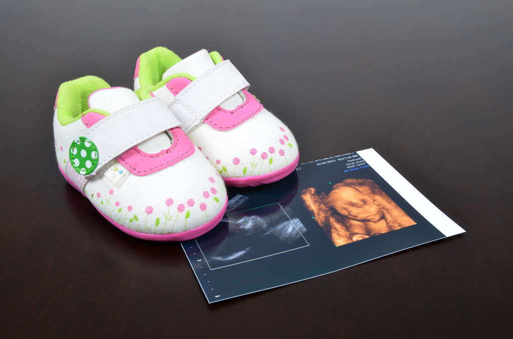 医学超声图像的婴儿鞋照片 医学超声图像的婴儿鞋照片