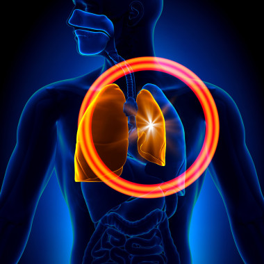 气胸-详细的肺萎陷图片