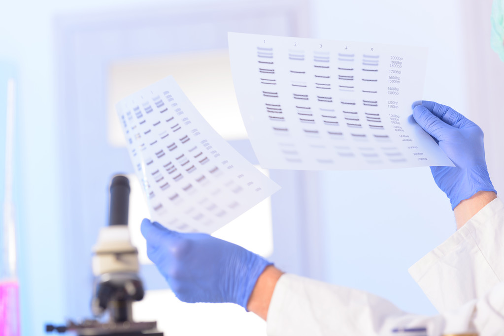 分析 dna 分析 dna