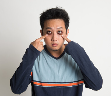 黑眼圈照片