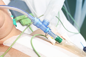 对病人的呼吸设备详细信息图片