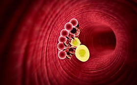 胆固醇血管图片