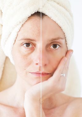 美概念-護(hù)膚、 抗衰老程序、 復(fù)興