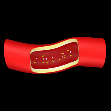 血液解剖学中的血浆