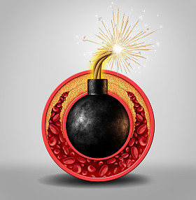 胆固醇的定时炸弹