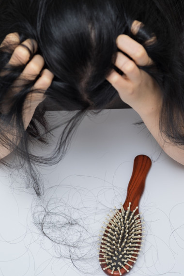 女人脫發(fā)問題圖片