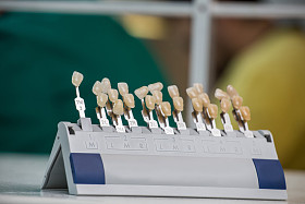 牙齿颜色的调色板的颜色匹配图片