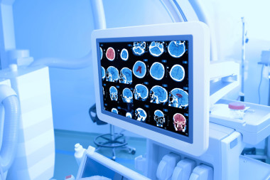 在 kathlabe 中監(jiān)視